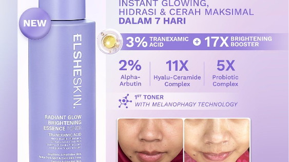 Elsheskin Radiant Glow Brightening Essence Toner (instagram/elsheskin)