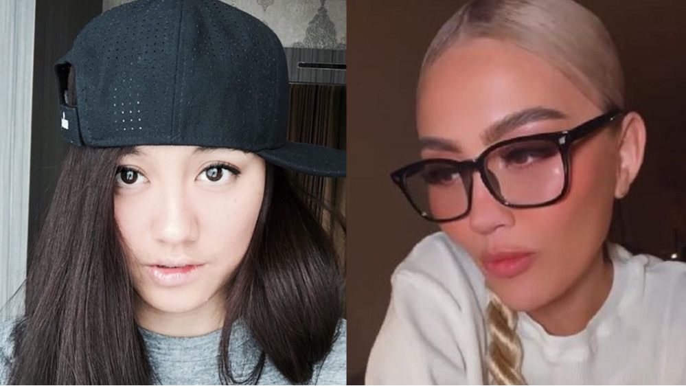 Potret Beda Wajah Agnez Mo Dulu Dan Sekarang (Instagram/@agnezmo)