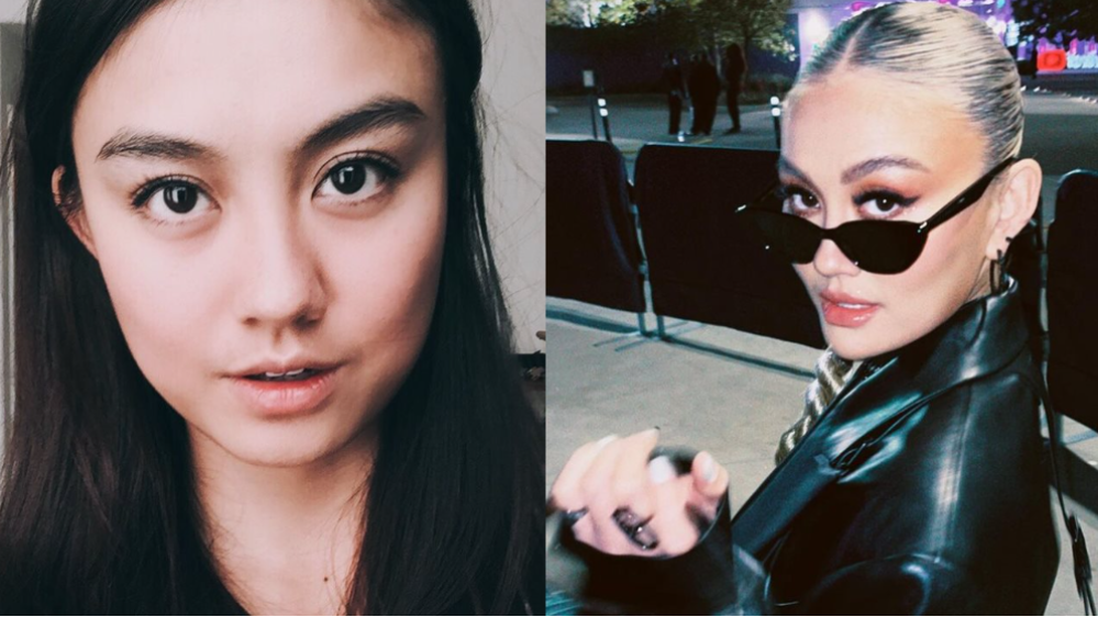 Potret Beda Wajah Agnez Mo Dulu Dan Sekarang (Instagram/@agnezmo)