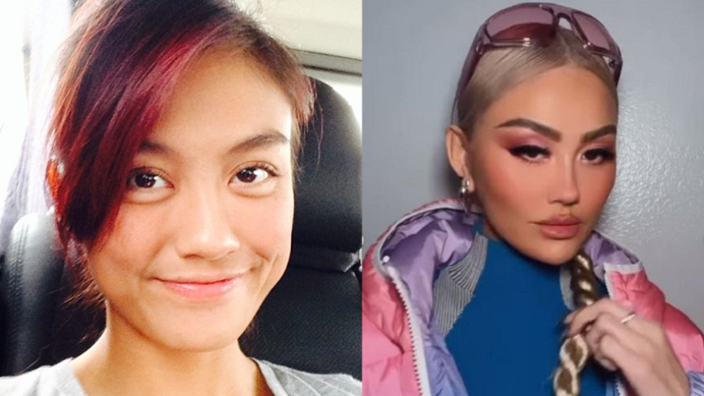 Potret Beda Wajah Agnez Mo Dulu Dan Sekarang (Instagram/@agnezmo)