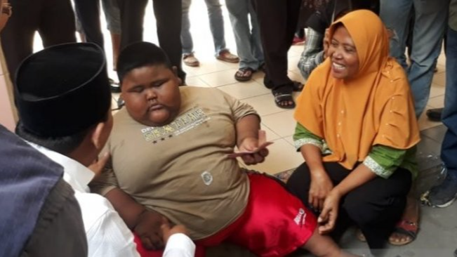 Satia Putra, Bocah yang Meninggal karena Obesitas (ANTARA)