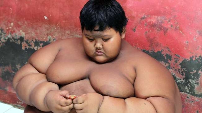 Bocah Penderita Obesitas, Arya Permana (Suara.com/Caters News Agency)